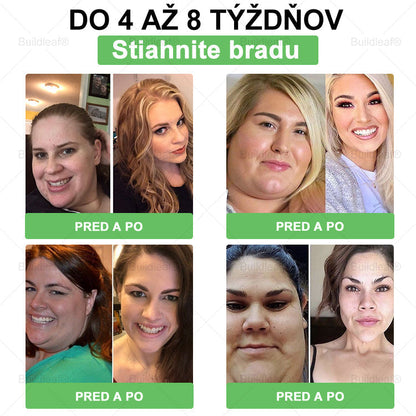 🧑‍⚕️🧑‍⚕️BuildLeaf® GLP-1 8-v-1 Fit & Vital Perorálny Roztok (Len raz denne, viditeľné zmeny už za 7 dní) Pre obezitu, kardiovaskulárne ochorenia, cukrovku, spánkové apnoe, zdravie čriev, problémy s kĺbmi a ďalšie