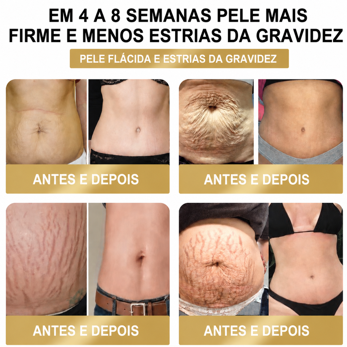 Adesivo Premium 10 em 1 à Base de Ervas Naturais com Veneno de Abelha  (Mudanças visíveis em apenas 7 dias)  ✅ Para gestão do peso, cuidados com a pele, controlo da glicemia, bem-estar respiratório durante o sono, desconforto nas articulações e muito mais