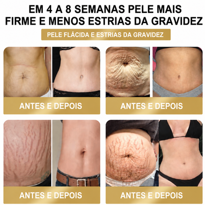 Adesivo Premium 10 em 1 à Base de Ervas Naturais com Veneno de Abelha  (Mudanças visíveis em apenas 7 dias)  ✅ Para gestão do peso, cuidados com a pele, controlo da glicemia, bem-estar respiratório durante o sono, desconforto nas articulações e muito mais