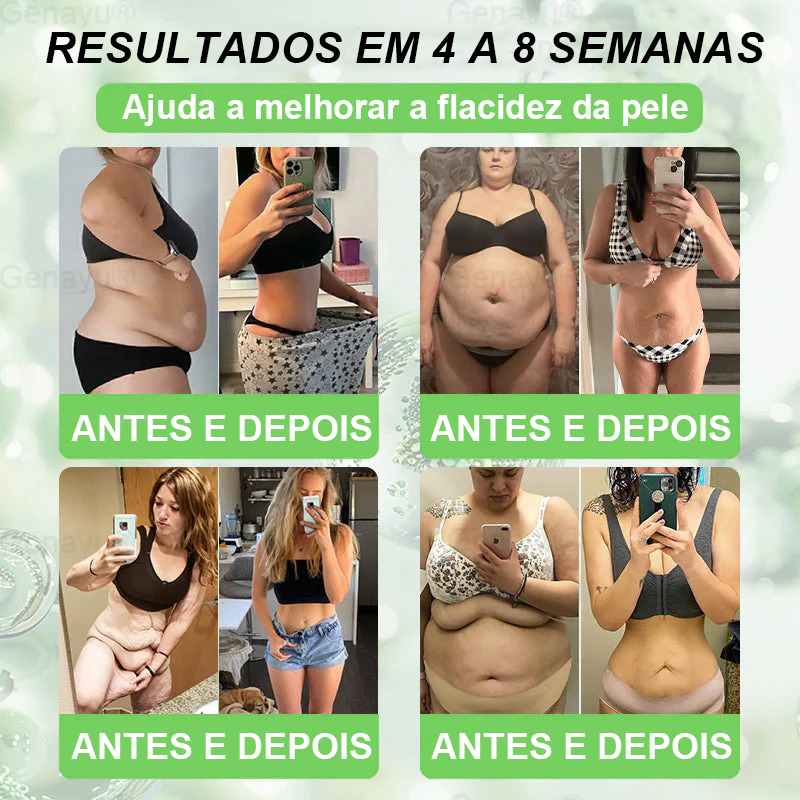 🥕 Novo e Atualizado em 2026 | 🌿 𝑫𝑶𝑻𝑨𝑳𝑬® 𝑴𝒐𝒓𝒊𝒏𝒈𝒂 · 𝑩𝒆𝒓𝒃𝒆𝒓𝒊𝒏𝒂 × 𝑵𝑨𝑫+ 𝑨𝒅𝒆𝒔𝒊𝒗𝒐 𝑨𝒗𝒂𝒏ç𝒂𝒅𝒐 𝑵𝒂𝒏𝒐 𝑴𝒊𝒄𝒓𝒐𝒏𝒆𝒆𝒅𝒍𝒆 10 𝒆𝒎 1✅ Ajuda a combater a obesidade, a flacidez da pele, a diabetes, a apneia do sono, os problemas nas articulações e muito mais